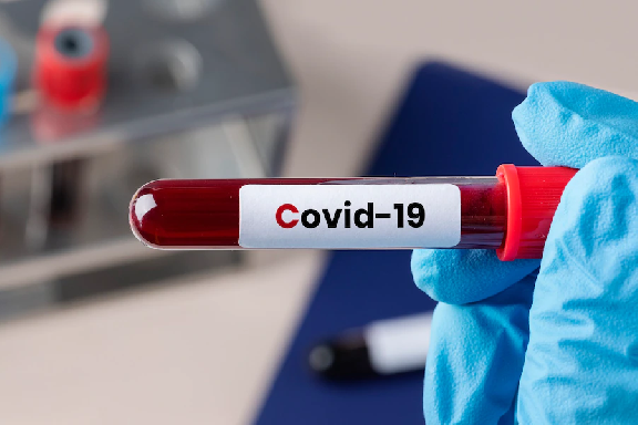 За прошедшую неделю коронавирусом заболели 137 тамбовчан